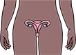 Having an operation to remove womb and ovaries, to lower the chance of cancer